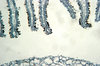 Fungus - microscopic view of s