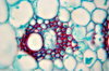 Maize - microscopic view of st