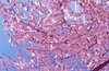 Cherry Blossoms