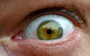 Eyeball 01