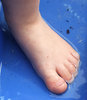 wetfoot