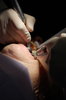 Dental Work