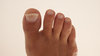 Foot 1