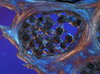 Cancellous Bone 5