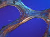 Cancellous Bone 2