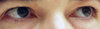 Tired Eyes