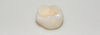 Milk tooth