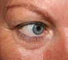 eye