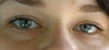 eyes again...