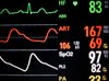 Medical monitoring in detail