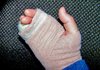 Broken Hand