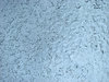 Ice texture