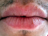 Mouth Close Up